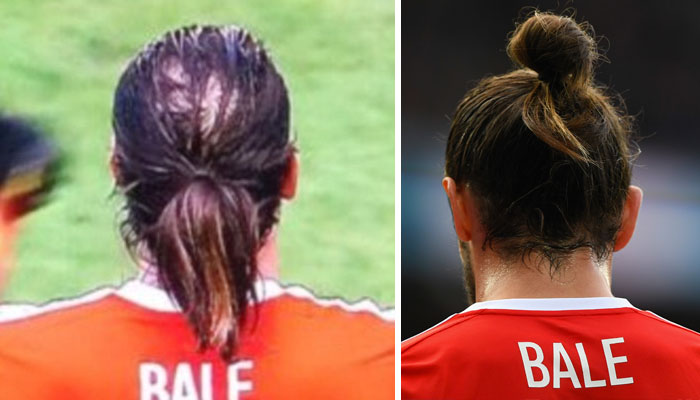 Beckham và những ngôi sao bóng đá tút lại vẻ đẹp trai nhờ phương pháp cấy tóc - Ảnh 6.