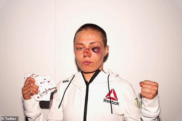 Nữ võ sĩ gặp chấn thương kinh hoàng sau chiến thắng hú hồn tại UFC - Ảnh 2.