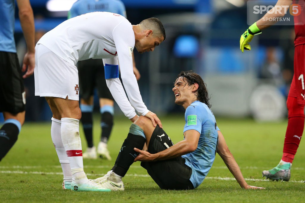 Uruguay và Colombia đau đầu: Cavani tập tễnh bước đi, James Rodriguez không thể tập luyện - Ảnh 3.