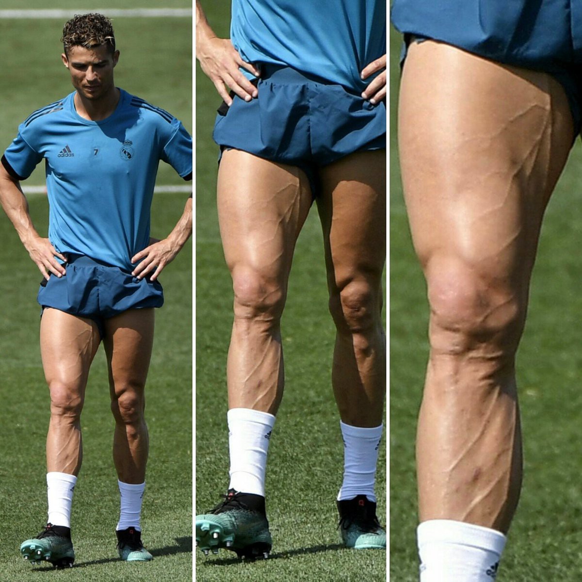 Sửng sốt trước hình ảnh đôi chân chằng chịt dây điện của VĐV xe đạp nổi tiếng, kinh hãi đến mức cặp giò của Ronaldo vẫn không là đối thủ - Ảnh 4.