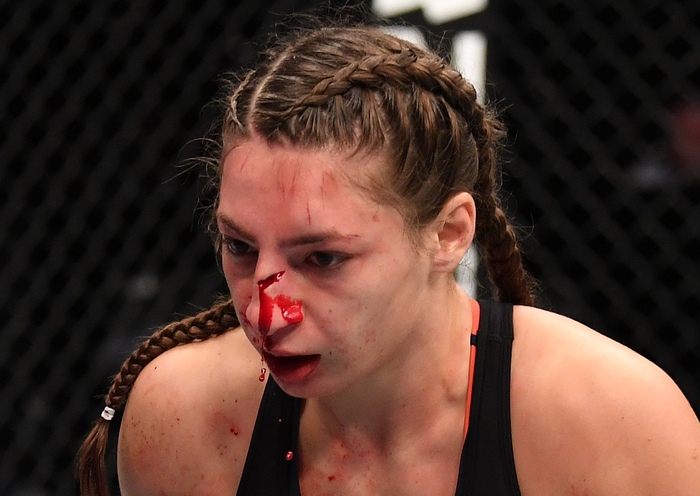 Nữ võ sĩ gặp chấn thương kinh hoàng sau cú đòn của đối thủ, fan tiếc nuối cho nhan sắc xinh đẹp của cô nàng - Ảnh 2.