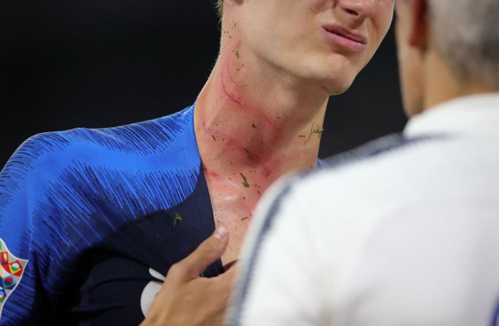 Hậu vệ tuyển Pháp bị đồng nghiệp tuyển Đức giẫm lên cổ, đá vào gáy - Ảnh 2.
