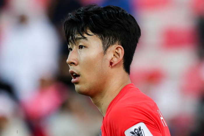 Cầu thủ đắt giá nhất châu Á nỗ lực cống hiến cho Hàn Quốc đến mức chảy cả máu vành tai - Ảnh 5.