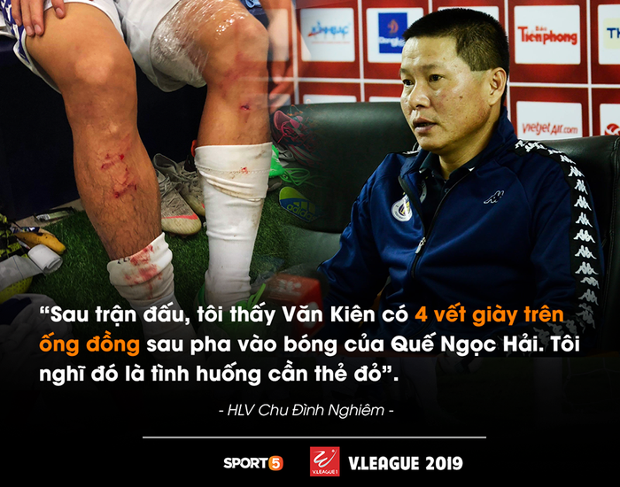 HLV Hà Nội FC: Quế Ngọc Hải xứng đáng nhận thẻ đỏ với 4 vết giày đinh hằn trên ống đồng Văn Kiên - Ảnh 1.
