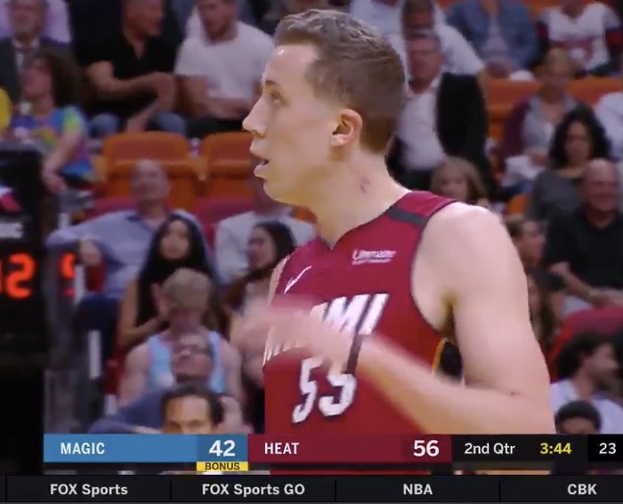 Duncan Robinson, hiện tượng của Heat gây náo loạn cộng đồng mạng với &quot;nụ hôn ma cà rồng&quot; trên cổ - Ảnh 2.