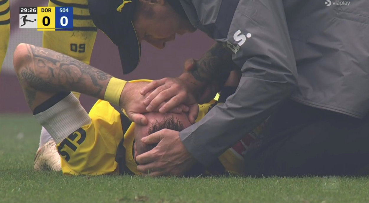 3 chấn thương khiến Marco Reus 4 lần lỡ hẹn cùng tuyển Đức - Ảnh 3.