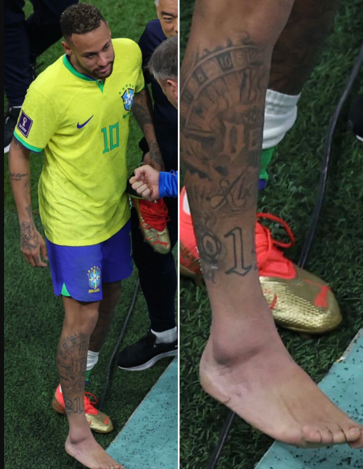Để 'cứu' Brazil, Neymar có thể tiêm giảm đau, mặc đồ bảo hộ ra sân - Ảnh 2.
