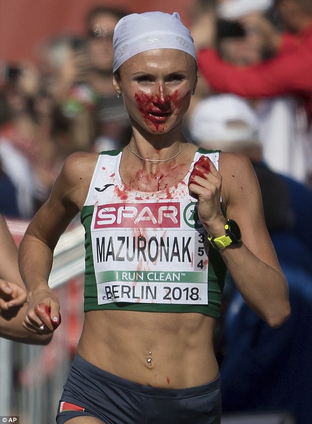 Bị chảy máu cam và chạy sai đường, nữ VĐV marathon vẫn kiên cường về nhất - Ảnh 1.