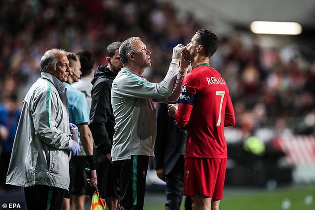 Chảy máu mũi và dính chấn thương đùi, Ronaldo sớm rời sân mang theo lo lắng của fan - Ảnh 2.
