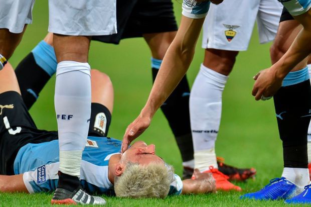 Trọng tài bẻ còi sau khi xem lại pha đánh yêu khiến đối phương đầm đìa máu tại Copa America 2019 - Ảnh 2.