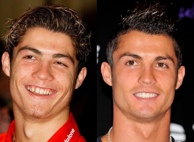 Cười sái hàm với bức ảnh thời trẻ trâu của Ronaldo: Hóa ra, idol của chúng ta đã có bước dậy thì cực kỳ thành công - Ảnh 5.