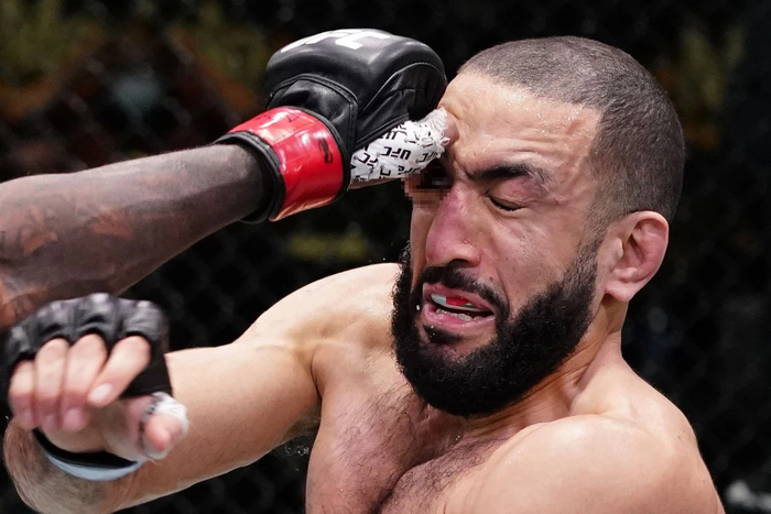 Dàn võ sĩ UFC yêu cầu thay đổi găng thi đấu sau sự cố chọc mắt của Leon Edwards - Ảnh 1.