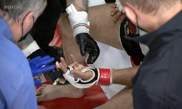 võ sĩ Pliev bị gãy ngón tay trong trận đấu vào ngày 2/4