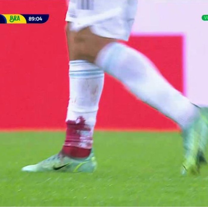 Hậu vệ Argentina chảy be bét máu ở chân nhưng vẫn nhận thẻ vàng tại chung kết Copa America - Ảnh 1.