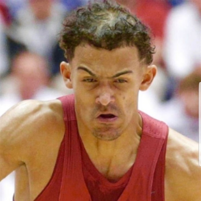 Hói đầu, rụng tóc: Cái giá để trở nên vĩ đại của siêu sao NBA - Ảnh 8.