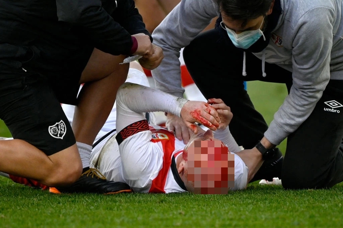 Rùng rợn: Cầu thủ ở La Liga chảy máu đầu đầm đìa khi lĩnh trọn cú đá của đối thủ - Ảnh 8.