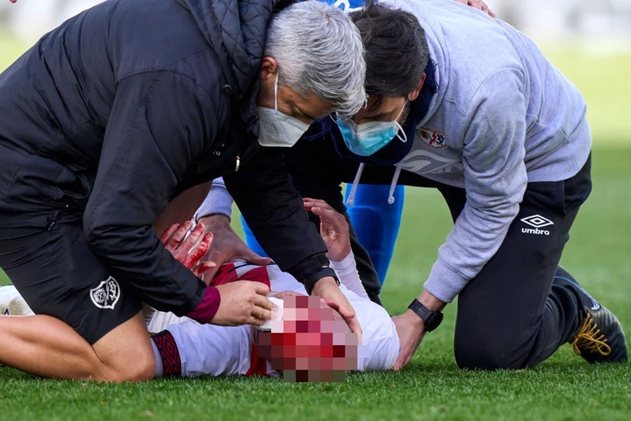 Rùng rợn: Cầu thủ ở La Liga chảy máu đầu đầm đìa khi lĩnh trọn cú đá của đối thủ - Ảnh 7.