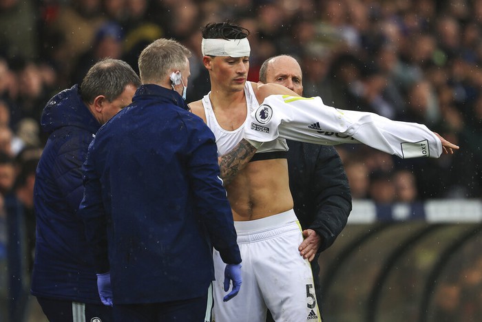 Cầu thủ Leeds chảy máu đầm đìa vì va chạm với sao MU - Ảnh 7.
