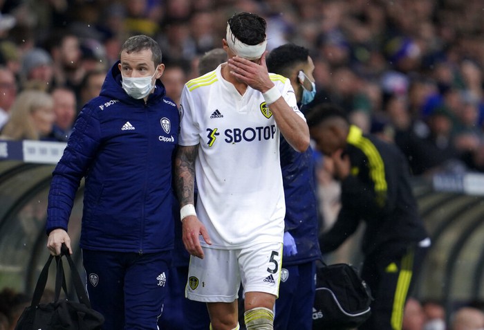Cầu thủ Leeds chảy máu đầm đìa vì va chạm với sao MU - Ảnh 6.