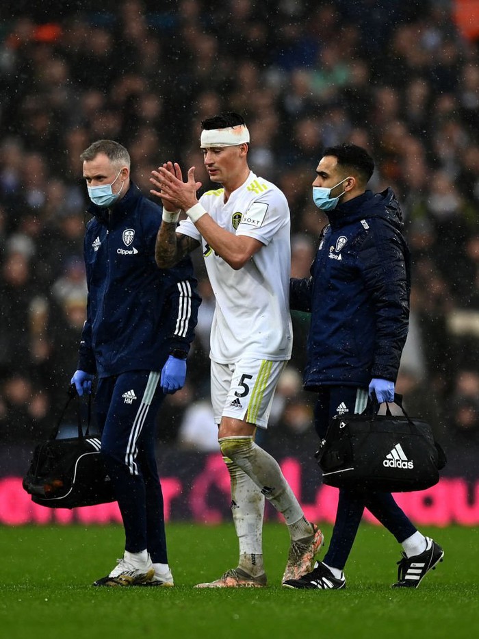 Cầu thủ Leeds chảy máu đầm đìa vì va chạm với sao MU - Ảnh 5.