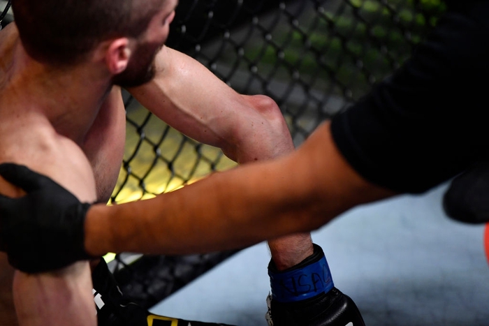 Võ sĩ gặp chấn thương tay kinh hoàng trong trận ra mắt UFC - Ảnh 3.