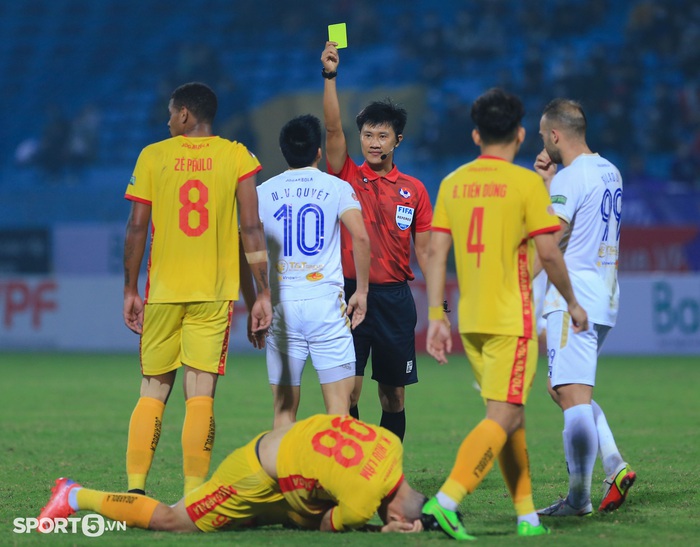 Cầu thủ Thanh Hoá nghi bị rạn xương ở trận thua Hà Nội FC - Ảnh 7.