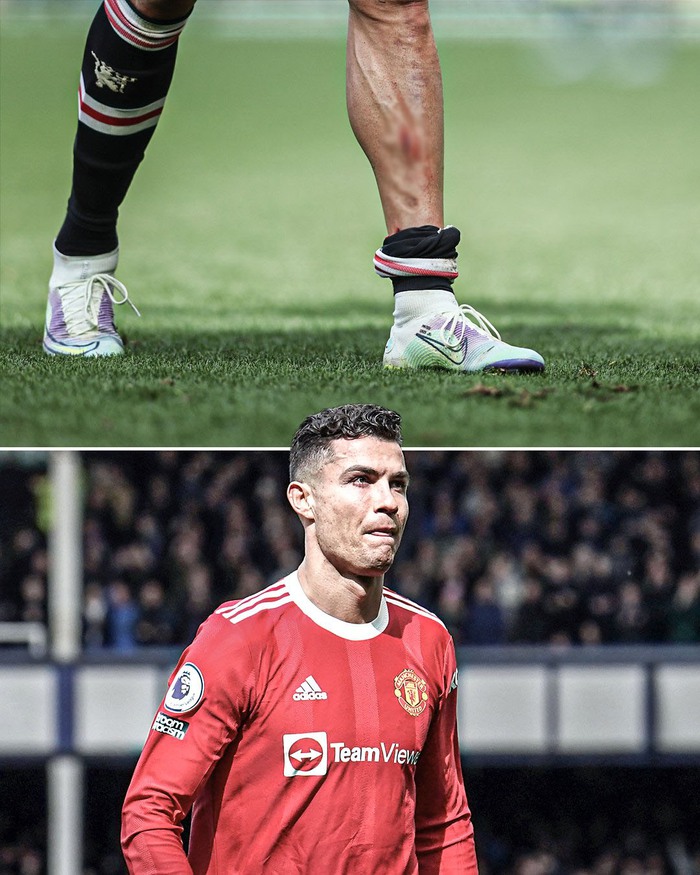Ronaldo đổ máu ở trận thua đáng xấu hổ của MU - Ảnh 2.