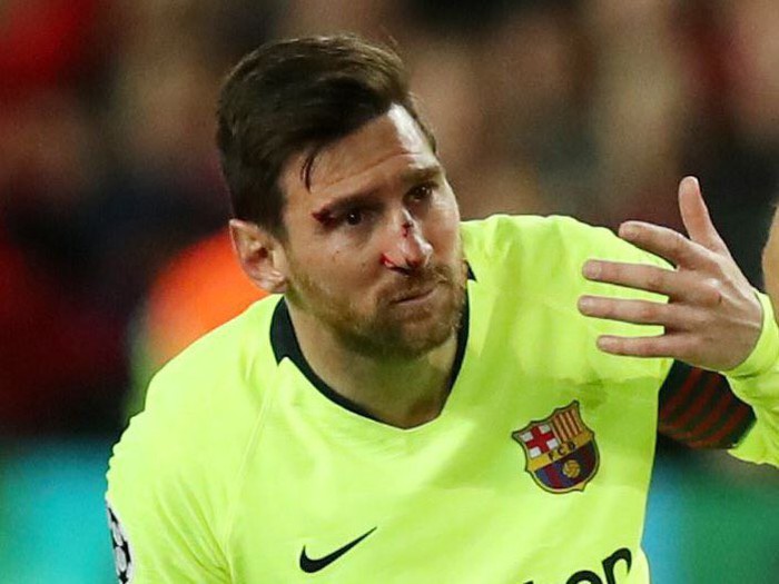 Messi chảy máu đầm đìa sau khi bị trung vệ MU gạt tay trúng mặt - Ảnh 3.