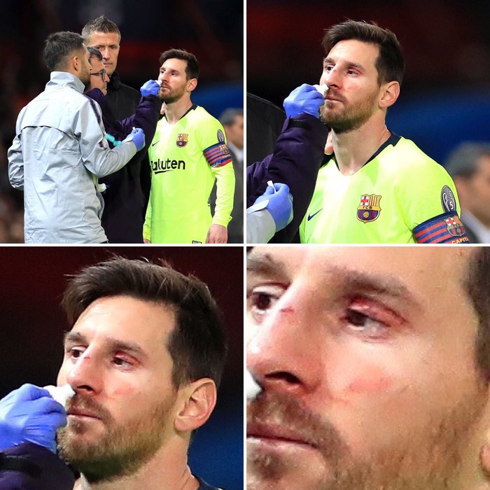 Messi chảy máu đầm đìa sau khi bị trung vệ MU gạt tay trúng mặt - Ảnh 4.