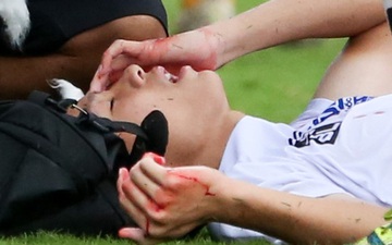 Cầu thủ trẻ HAGL chảy máu đầu sau va chạm vẫn cố thi đấu hết trận