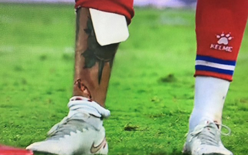 Không dùng miếng lót ống đồng, cựu cầu thủ Barca dính chấn thương kinh hoàng