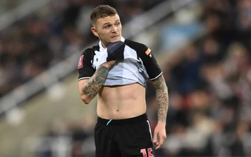 Sao tuyển Anh gãy chân, Newcastle mất "gà son" vì chấn thương nặng