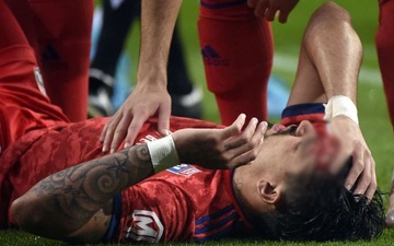 Sao Lyon rách đầu, chảy đẫm máu vì va chạm với Pepe