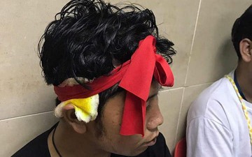 Không được hưởng niềm vui chiến thắng, CĐV Myanmar còn bị fan Malaysia đánh chảy máu đầu