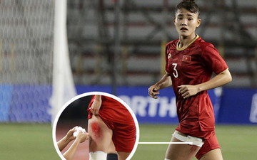 Fan xót xa hình ảnh nữ tuyển thủ Việt Nam rách đùi, băng gối vẫn thi đấu lăn xả: "Dù sao đấy cũng là một cô gái thôi mà"