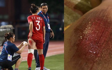Xót xa nhìn vết thương đau đớn khiến nữ trung vệ Việt Nam không ngủ nổi sau chiến thắng Thái Lan ở SEA Games 30